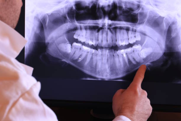 Best Orthodontic Emergency Dentist in Timberlake, VA