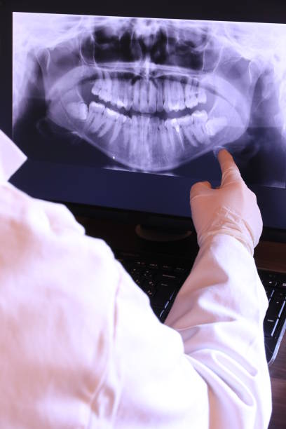 Best Emergency Dental Extractions in Timberlake, VA