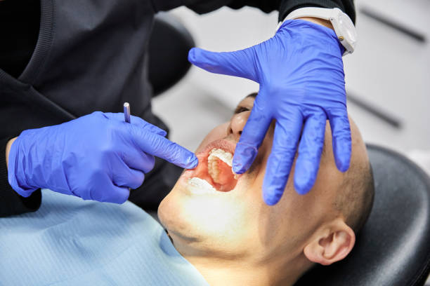 Best Urgent Dental Care for Toothache in Timberlake, VA